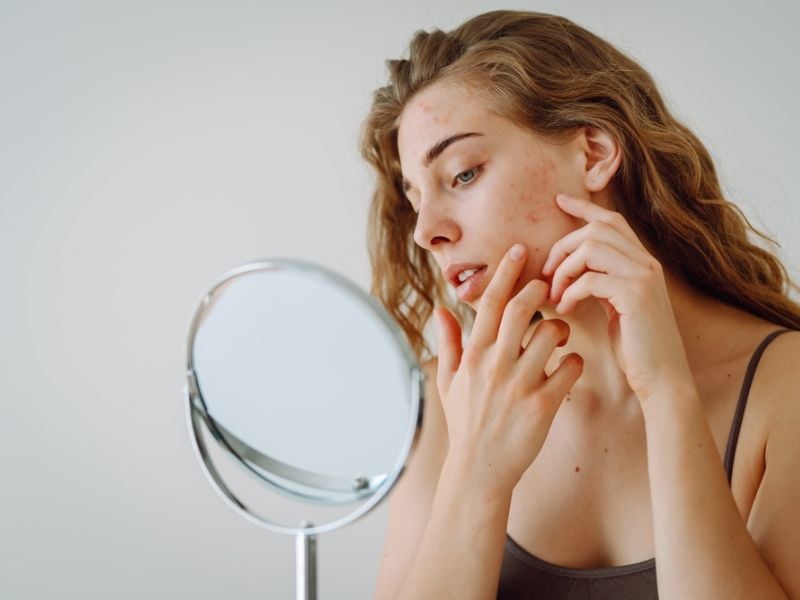 Hãy nhớ dùng sữa rửa mặt hoặc nước tẩy trang để làm sạch da trước khi đi ngủ.