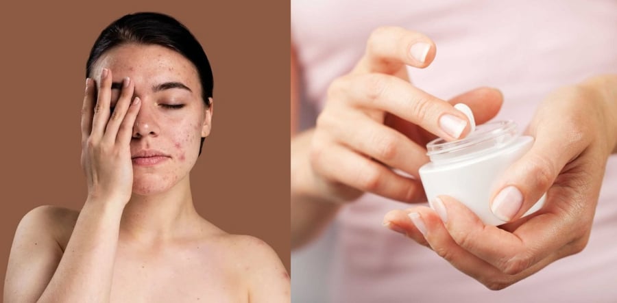 Các loại vi khuẩn không chỉ khiến da bị viêm & nhiễm trùng, nổi mụn trứng cá mất kiểm soát mà còn ảnh hưởng đến các bộ phận khác trên cơ thể