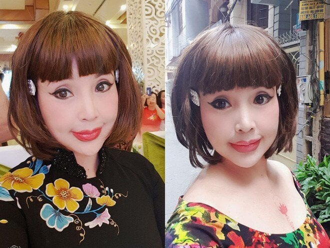 Cô từng lên tiếng thừa nhận đã can thiệp 2 bên má nhưng phủ nhận đã can thiệp vào vùng môi và mũi và cho rằng việc