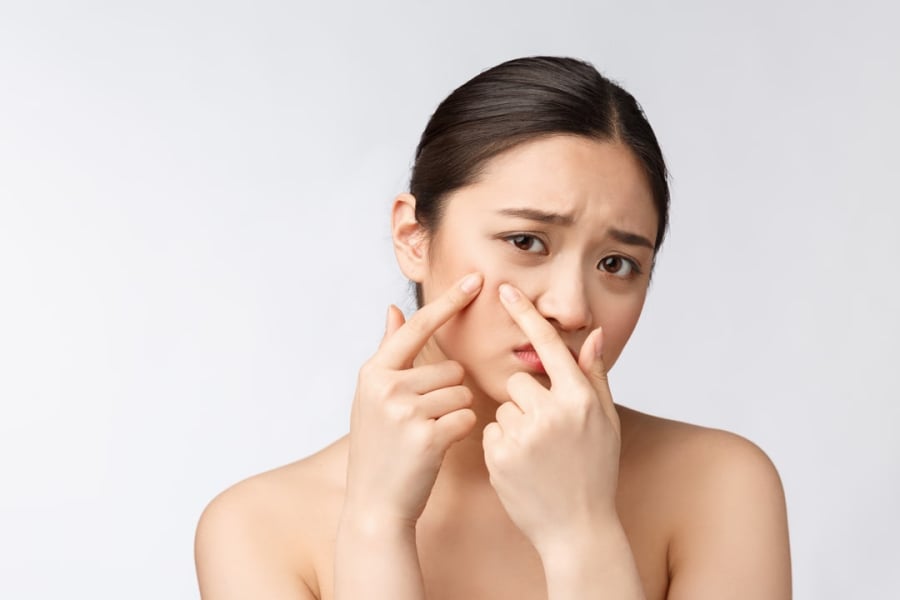 Mụn trứng cá khiến bạn tự ti về vẻ ngoài của mình