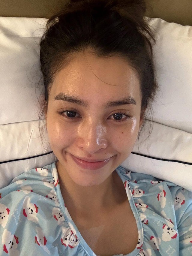 Nàng Hậu nhiều khuyết điểm như nước da không đều màu, nhiều vết thâm ở hai vùng gò má và cằm; phần bọng mắt khá lớn.