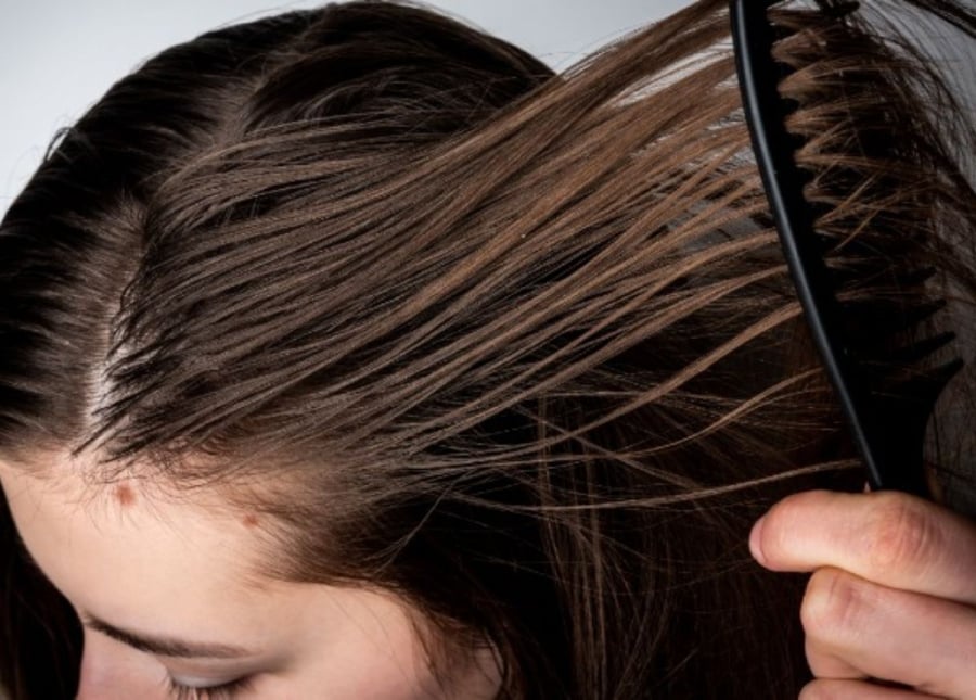 Massage da đầu với tinh dầu trước mỗi lần gội đầu sẽ góp phần bổ sung độ ẩm cho da, nhờ đó kiểm soát phần nào tình trạng nhờn dính.