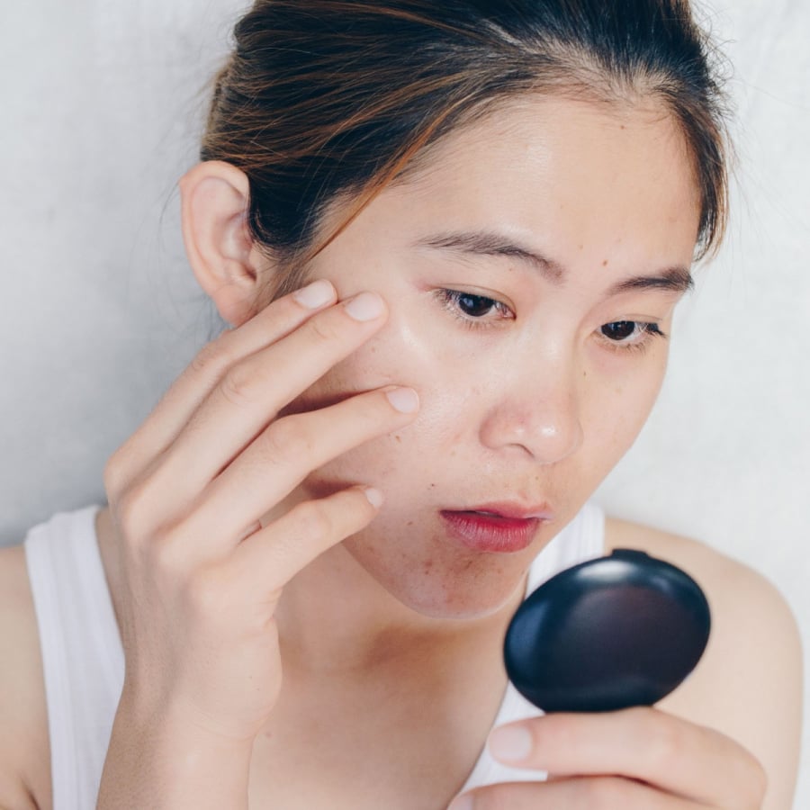 Niacinamide còn được khuyên dùng với những làn da nhạy cảm, đang trong quá trình điều trị da hoặc phục hồi da khi đang dùng treatment như Retinol, Tretinoin.