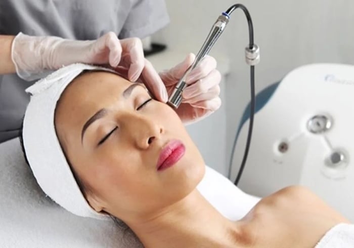 Trị nám bằng tia laser đang rất nhiều chị em tin dùng và khá hiệu quả. (Ảnh minh họa)