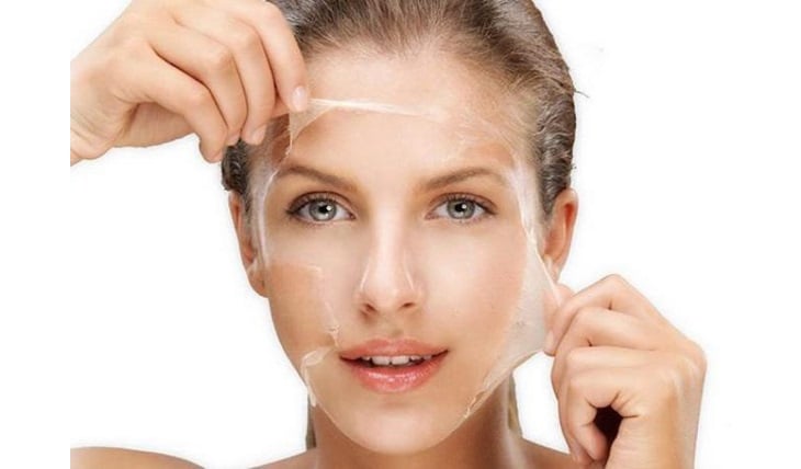 Nhiều chị em tin rằng lột da trị nám rất hiệu quả, vậy thực hư ra sao? (Ảnh minh họa)