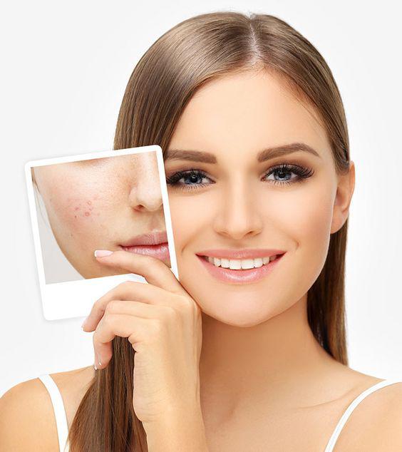 Khoai tây có chứa niacin là thành phần nổi bật khi làm sáng sắc tố trên da