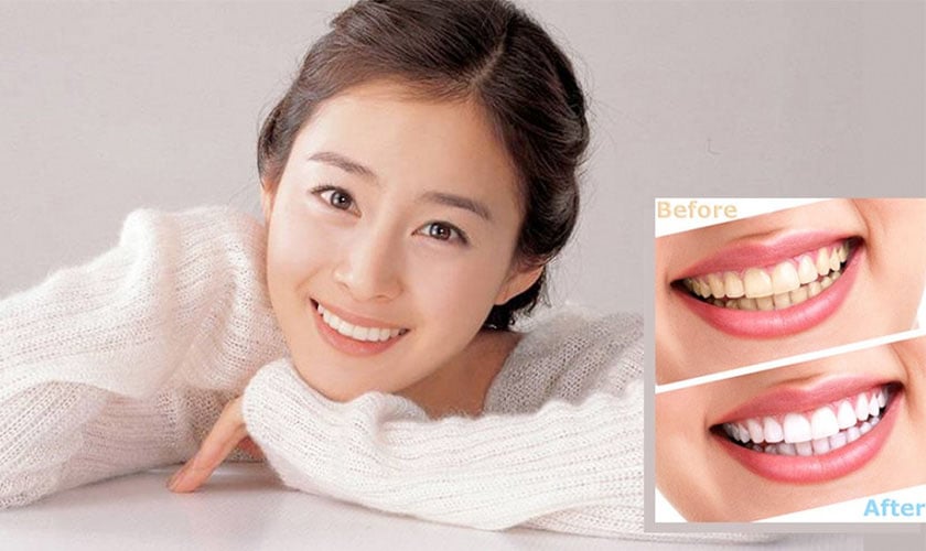 Dùng hỗn hợp vỏ chanh, bột nở và muối để đánh răng sau khi đánh răng bằng kem.