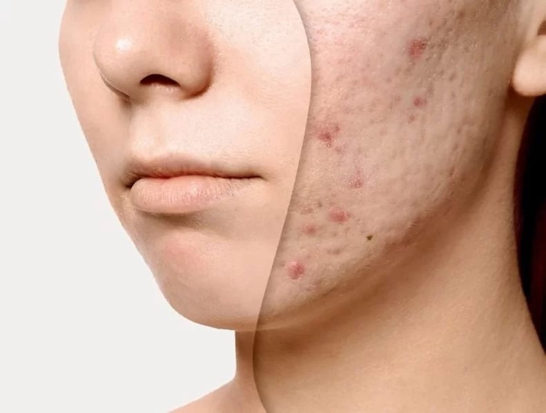 Tẩy tế bào chết bằng cà phê tốt để làm da sáng mịn hơn.