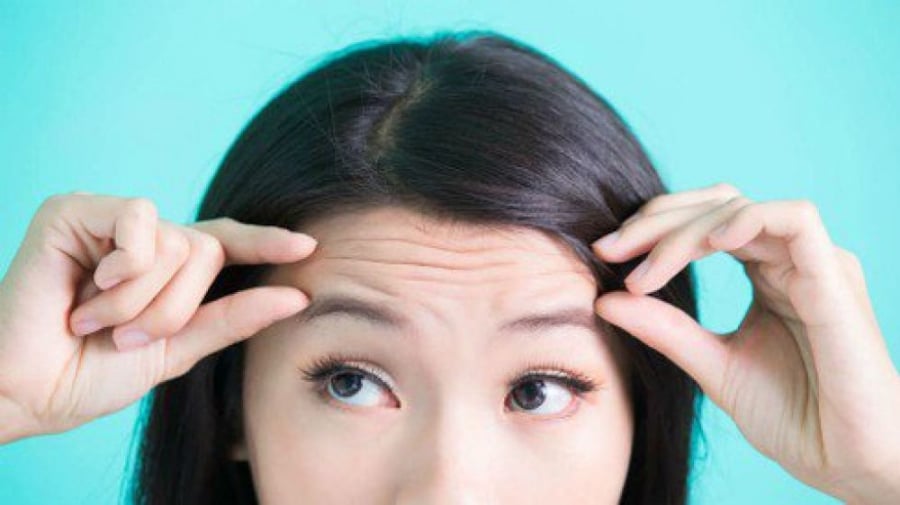 Vùng da trên trán thường dễ xuất hiện nếp nhăn, do các lớp tế bào dưới da tại đây thường mỏng.