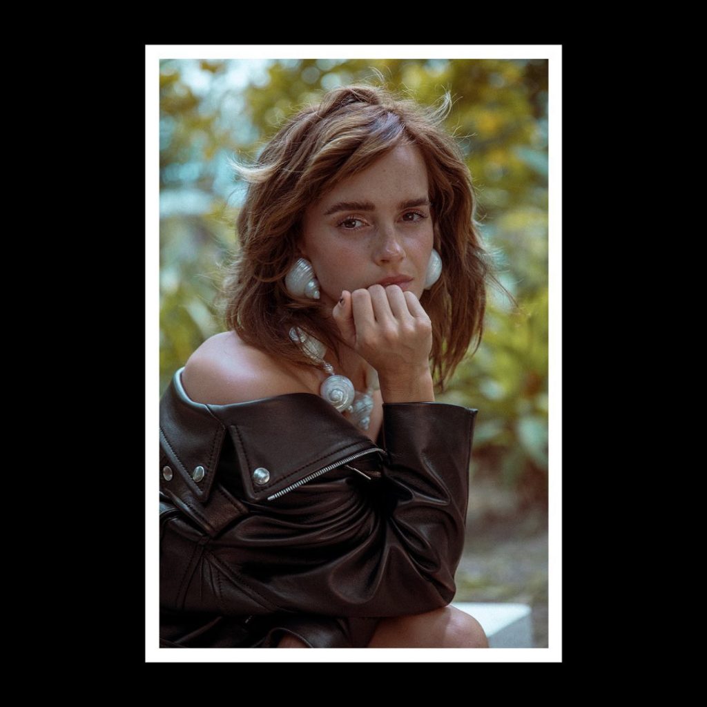 tự tin với tàn nhang như thần tượng emma watson của bạn