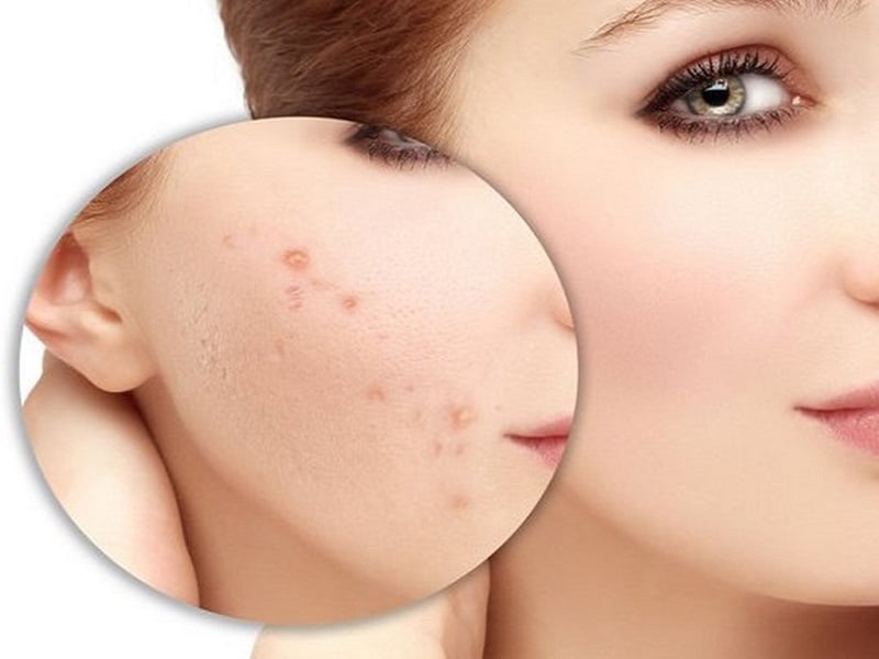 Các sản phẩm giúp kích thích tăng sinh collagen sẽ làm đầy da.