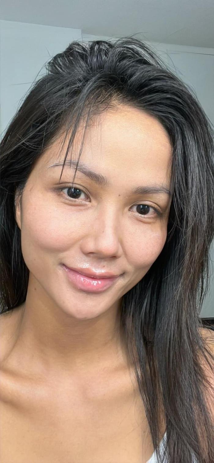 Cô đã sử dụng kem trộn không rõ nguồn gốc trong một khoảng thời gian dài khoảng 9 năm từ năm 2012.