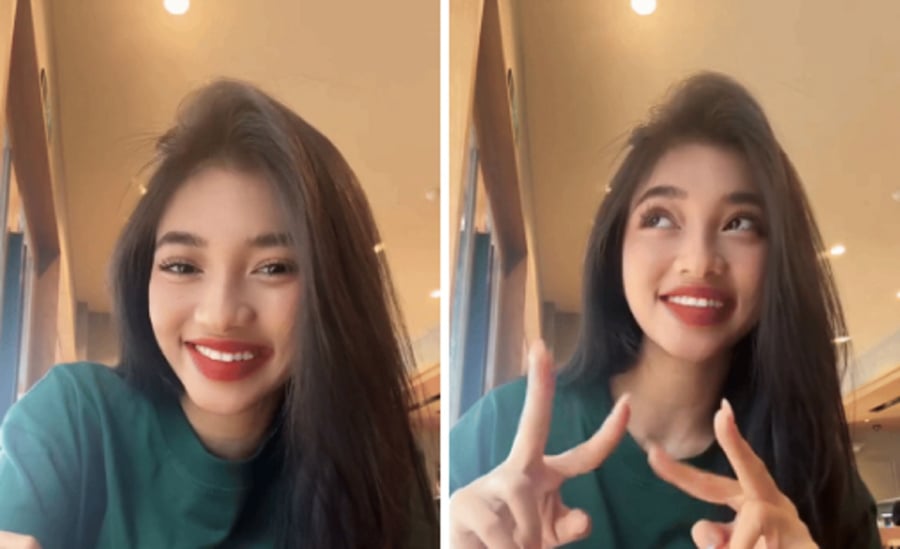 Á hậu Minh Kiên tiết lộ mình đang trong quá trình niềng.