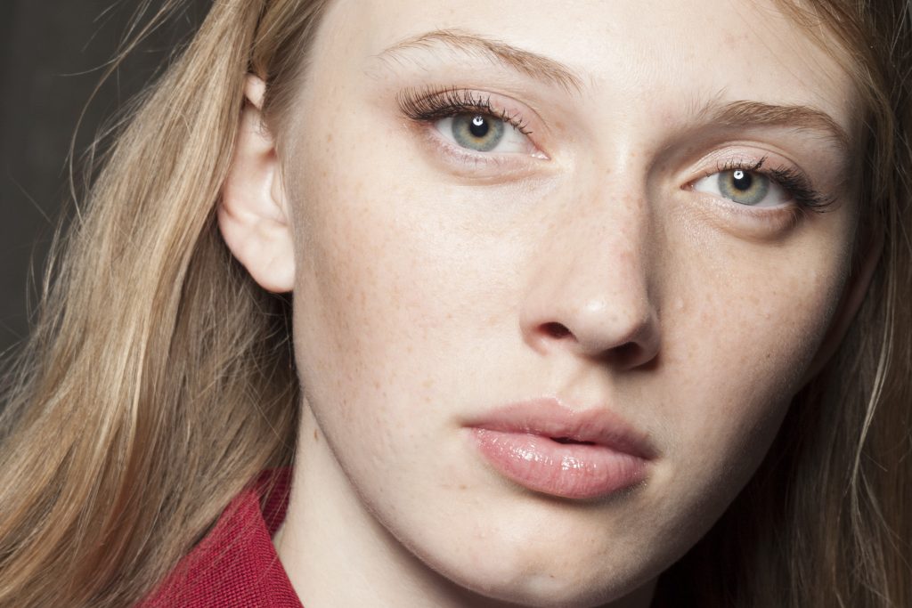 cô gái da trắng sáng có tàn nhang