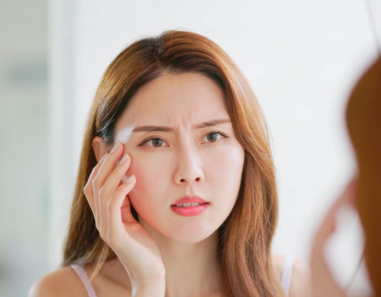 Xuất hiện do sự mất cấu trúc đàn hồi trong da, chủ yếu từ việc tiếp xúc với ánh nắng mặt trời và lão hóa.