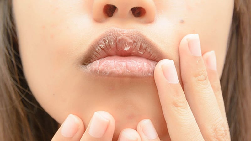 Nhiều chị em gặp phải tình trạng khô môi sau khi sử dụng son bóng.
