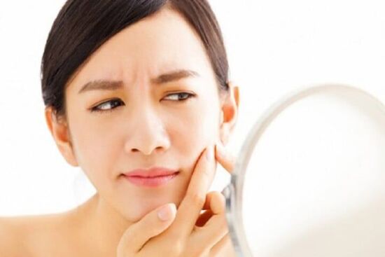 Tác hại không tưởng của việc ăn đường "thả ga" mà ít chị em biết đến