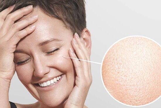 Mách nàng cách xử lý tình trạng lỗ chân lông to, là phẳng làn da sần sùi