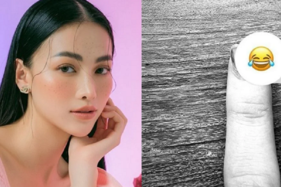 Một nàng Hâu Vbiz tiết lộ tình trạng sức khỏe đáng lo ngại, bị thương đến bật cả móng tay