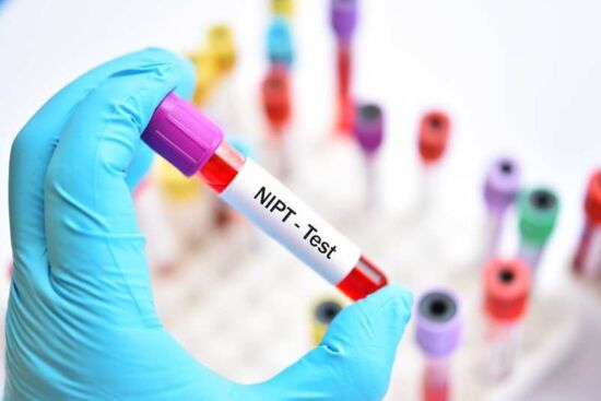 Mẹ bầu có nên làm xét nghiệm NIPT không?