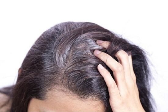 Ghim ngay những tips tự nhiên bảo vệ tóc bạc sớm, giúp nàng tự tin khoe sắc