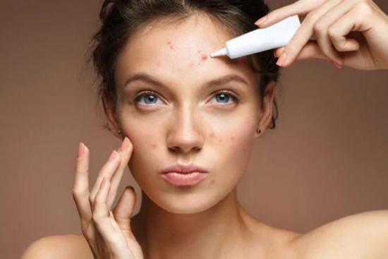 Vị trí nổi mụn trên mặt, cho thấy cơ thể bạn đang gặp những vấn đề sức khỏe như thế nào?