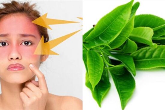 8 lợi ích của trà xanh đối với sức khỏe làn da và vóc dáng