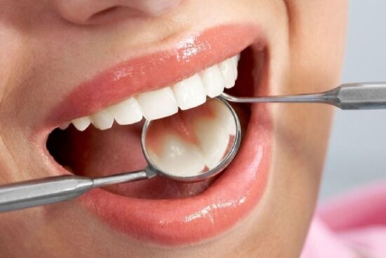 Bí kíp loại bỏ nhanh chóng các mảng bám răng cứng đầu giúp răng trắng sáng