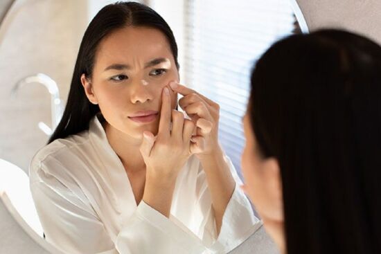 Bạn nên tránh xa những sai lầm sau khi xử lý mụn đầu đen để da láng mịn hơn