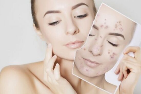 Bât mí loạt công thức làm đẹp từ A đến Z của sữa chua chị em nên tham khảo