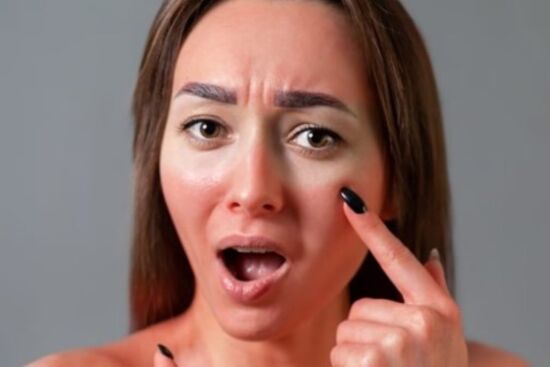 Làn da bị cháy nắng, 4 cách khắc phụ hiệu quả tại nhà