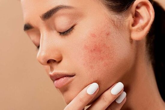 4 sai lầm cơ bản khi dùng toner cần loại bỏ ngay để da khỏe mạnh, sáng mịn và chậm lão hóa