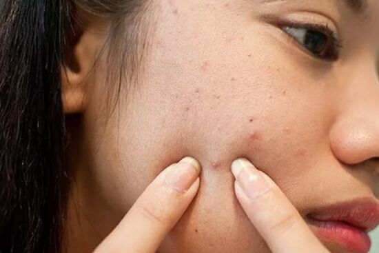 6 sai lầm phổ biến khi chăm sóc da mà bạn cần phải tránh nếu không muốn da xuống cấp
