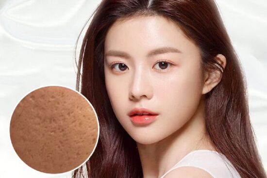 Mẹo xử lý sẹo rỗ phục hồi làn da căng mịn, giúp da sạch và sáng khỏe