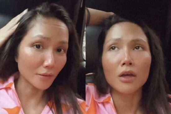 H'Hen Niê tiết lộ bị rụng nhiều tóc do stress, nên giải quyết tình trạng này như thế nào?