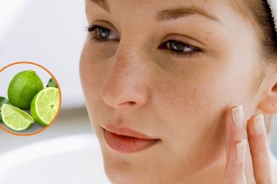 5 cách trị tàn nhang tự nhiên, đơn giản và hiệu quả