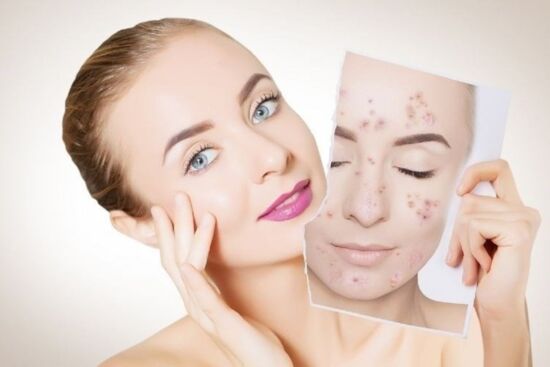 Muôn vàn lợi ích tuyệt vời của nước muối đối với làn da và mái tóc mà bạn nên biết