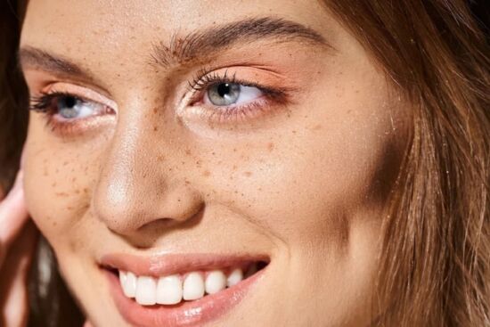 Mẹo đánh bay tàn nhang để có làn da đều màu và rạng rỡ hơn