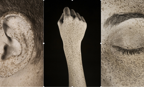 Tác hại của tia UV với làn da