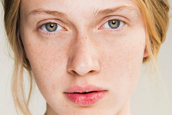 Bí quyết dưỡng da hữu hiệu nhất cho nàng da khô nhạy cảm