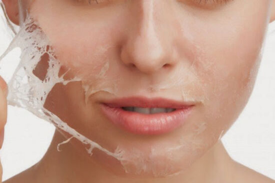 Tạm biệt làn da khô, bong tróc