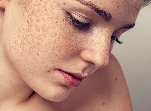 Nguyên nhân chính khiến chúng ta nhìn lão hoá