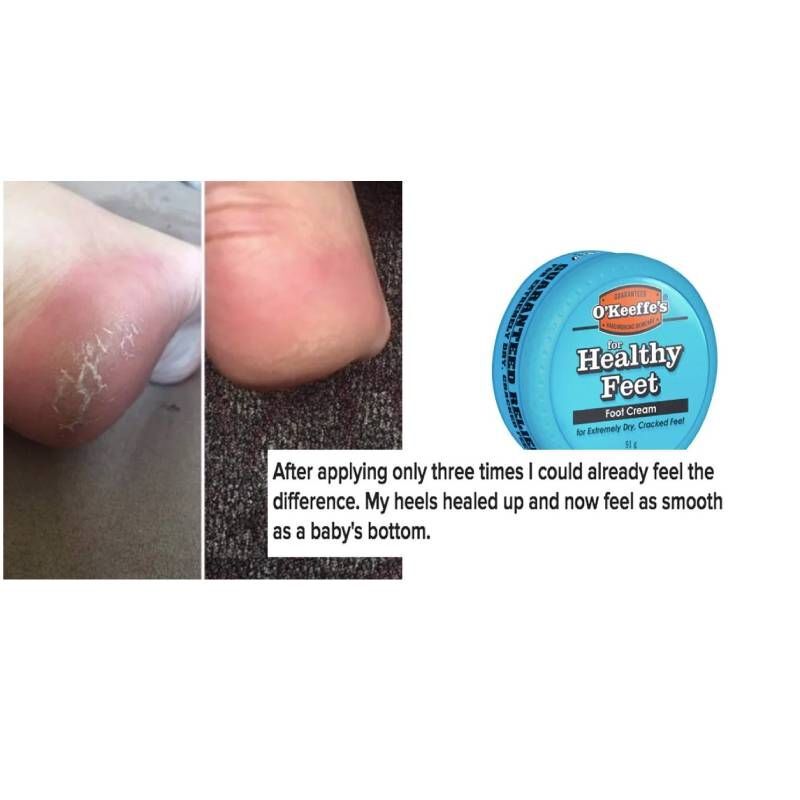 Kem đặc trị nứt gót chân O'Keeffe's for Healthy Feet Foot Cream của Mỹ